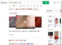 唱K离话筒太近感染无药可治_360搜索