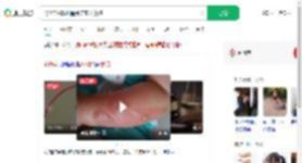 4岁娃碰热水桶烫伤家长索赔_360搜索