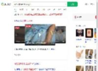海滩光脚踩到死鱼后进ICU_360搜索