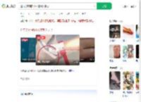 逛庙会不慎踩中木签刺入脚心_360搜索
