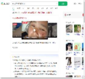 主人被养4年的猫狂咬_360搜索