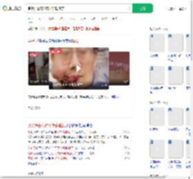 男子治癌花43万半张脸没了_360搜索